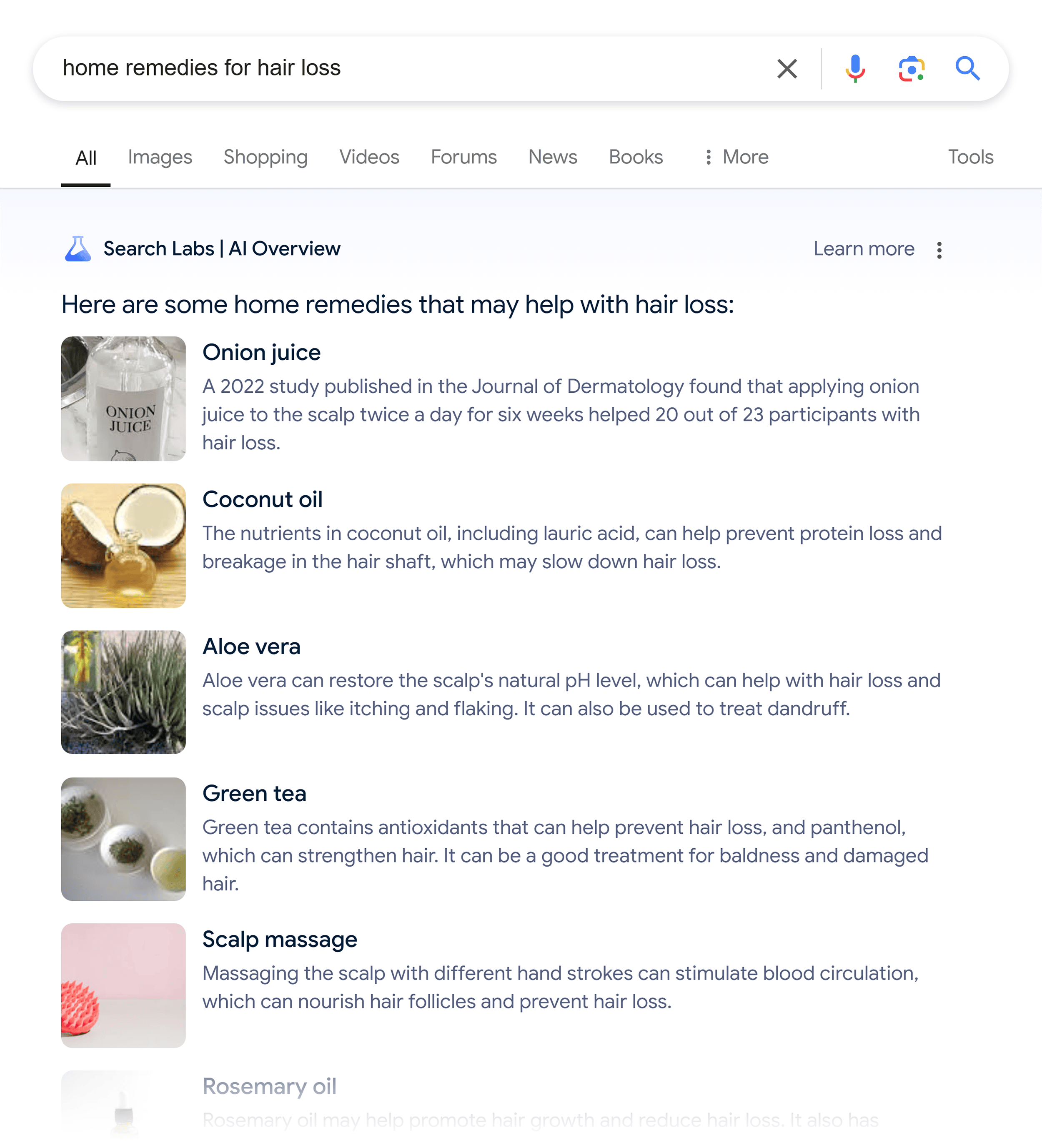 Google SERP – Home remedies for hair loss – AI Overview